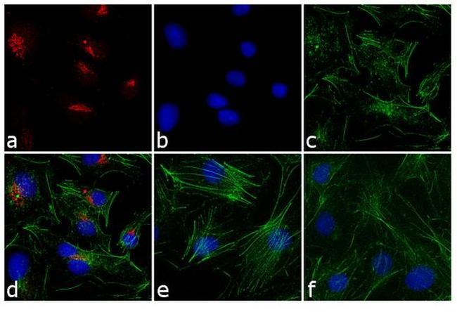 Rabbit IgG (H+L) Cross-Adsorbed Secondary Antibody in Immunocytochemistry (ICC/IF)