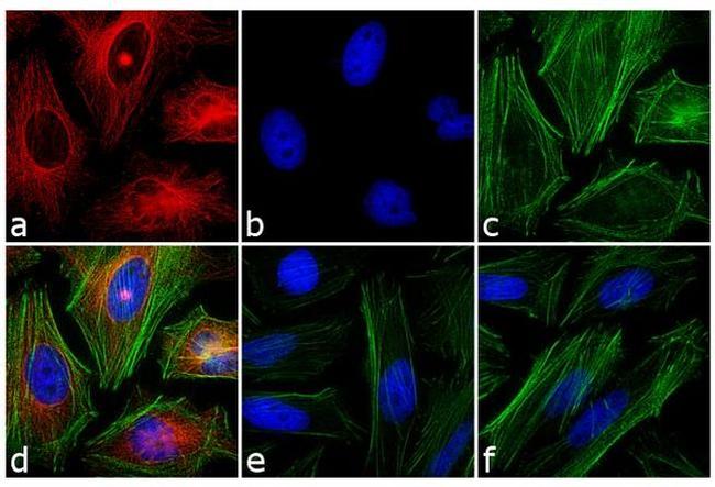 Mouse IgG1 Cross-Adsorbed Secondary Antibody in Immunocytochemistry (ICC/IF)