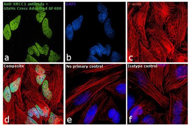 Mouse IgG2a Cross-Adsorbed Secondary Antibody in Immunocytochemistry (ICC/IF)