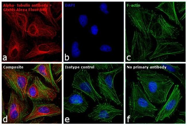 Mouse IgG (H+L) Cross-Adsorbed Secondary Antibody in Immunocytochemistry (ICC/IF)