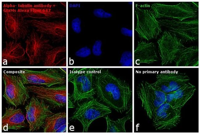 Mouse IgG (H+L) Highly Cross-Adsorbed Secondary Antibody in Immunocytochemistry (ICC/IF)