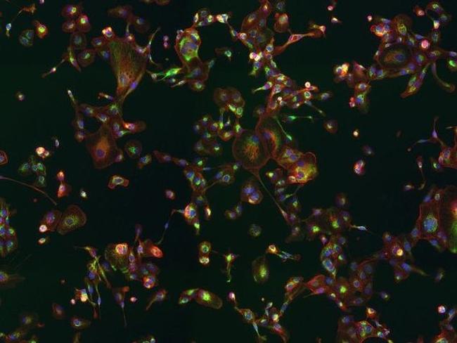 ATPIF1 Antibody in Immunocytochemistry (ICC/IF)