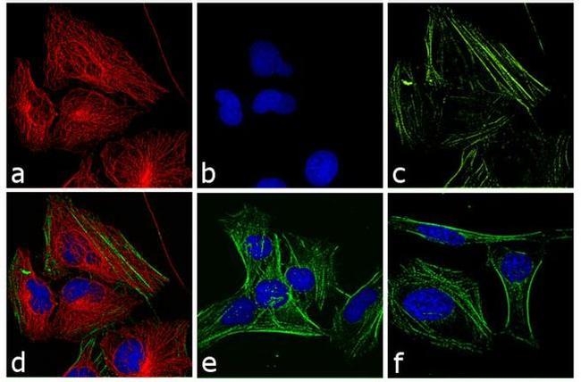 Rabbit IgG (H+L) Cross-Adsorbed Secondary Antibody in Immunocytochemistry (ICC/IF)