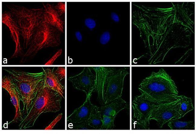 Rat IgG (H+L) Cross-Adsorbed Secondary Antibody in Immunocytochemistry (ICC/IF)