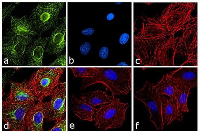 Rat IgG (H+L) Cross-Adsorbed Secondary Antibody in Immunocytochemistry (ICC/IF)