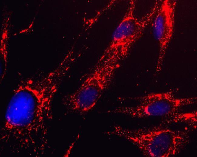 HADH Antibody in Immunocytochemistry (ICC/IF)