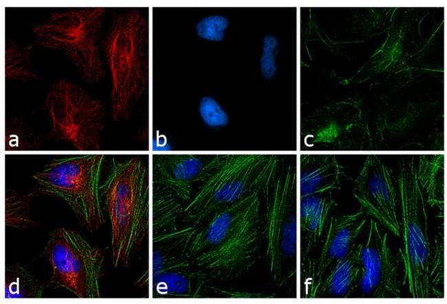 Mouse IgG (H+L) Highly Cross-Adsorbed Secondary Antibody in Immunocytochemistry (ICC/IF)