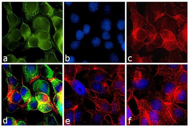 Mouse IgG (H+L) Secondary Antibody in Immunocytochemistry (ICC/IF)