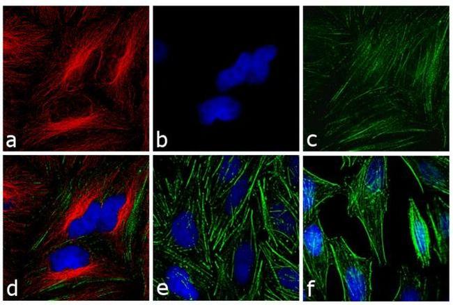 Mouse IgG (H+L) Secondary Antibody in Immunocytochemistry (ICC/IF)