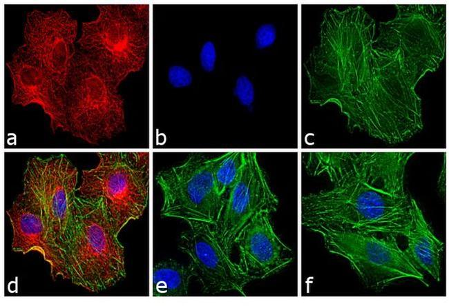 Rat IgG (H+L) Highly Cross-Adsorbed Secondary Antibody in Immunocytochemistry (ICC/IF)