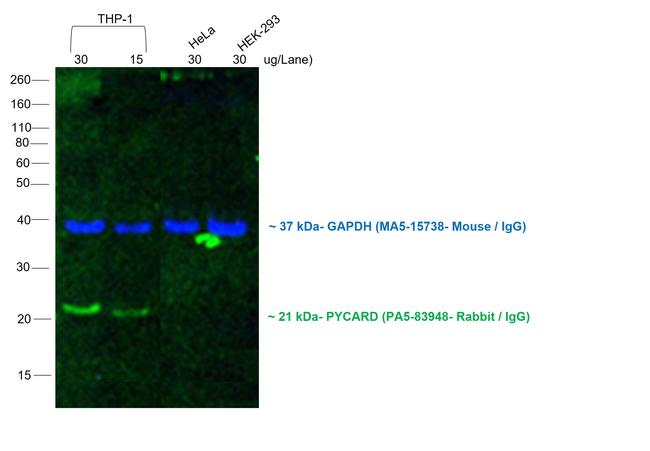 Rabbit IgG (Heavy chain) Secondary Antibody in Western Blot (WB)