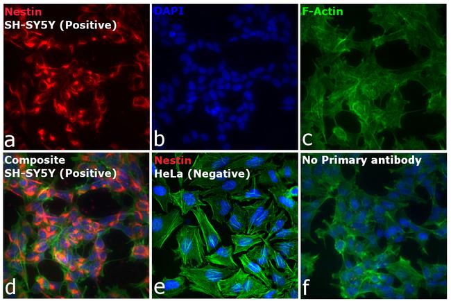 Mouse IgG (H+L) Secondary Antibody in Immunocytochemistry (ICC/IF)