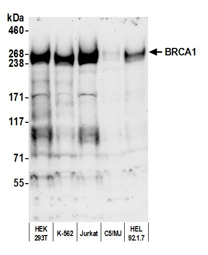 BRCA1 Antibody in Western Blot (WB)