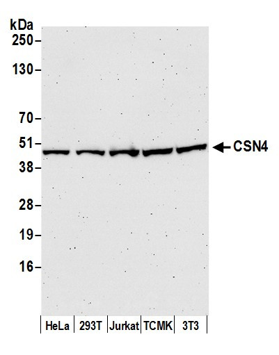 CSN4 Antibody in Western Blot (WB)