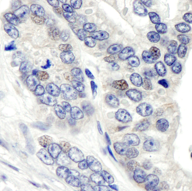 CSN1 Antibody in Immunohistochemistry (Paraffin) (IHC (P))