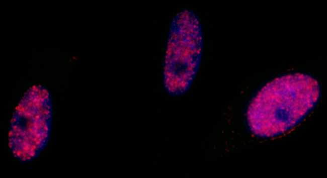 Phospho-SMC1 (Ser966) Antibody in Immunocytochemistry (ICC/IF)