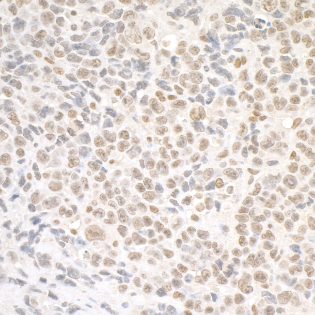 SMC1 Antibody in Immunohistochemistry (Paraffin) (IHC (P))