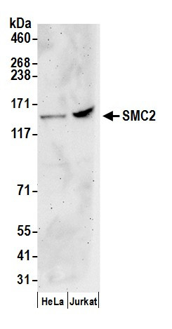 SMC2 Antibody in Western Blot (WB)