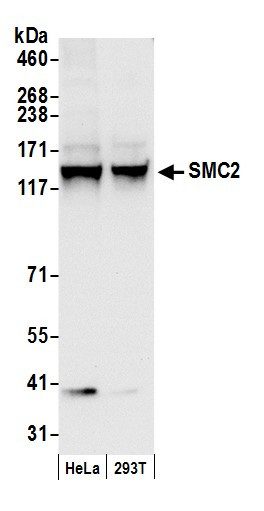 SMC2 Antibody in Western Blot (WB)