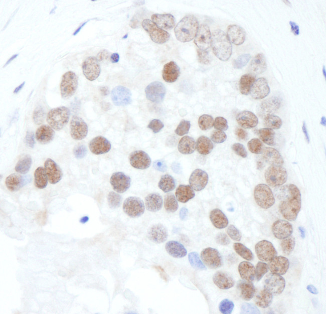 Phospho-XRCC1 (Ser518,Thr519,Thr523) Antibody in Immunohistochemistry (Paraffin) (IHC (P))