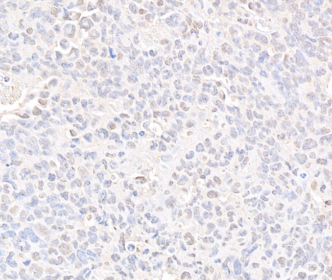 SMC3 Antibody in Immunohistochemistry (Paraffin) (IHC (P))