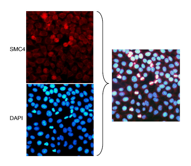 SMC4 Antibody in Immunocytochemistry (ICC/IF)