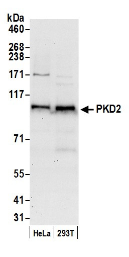 PKD2 Antibody in Western Blot (WB)