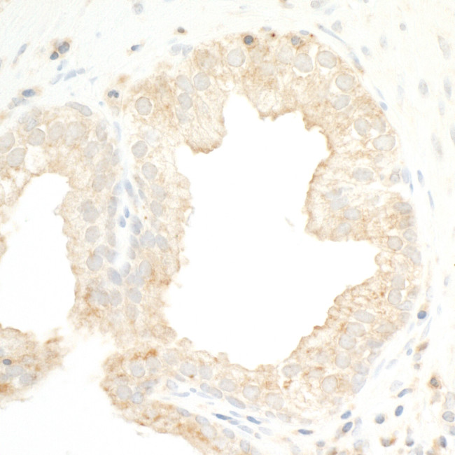 PKD2 Antibody in Immunohistochemistry (Paraffin) (IHC (P))