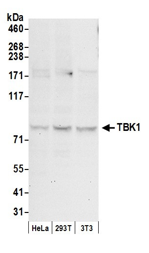 TBK1 Antibody in Western Blot (WB)