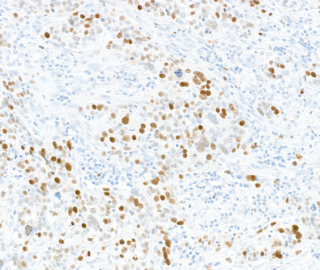 Phospho-MCM2 (Ser108) Antibody in Immunohistochemistry (Paraffin) (IHC (P))