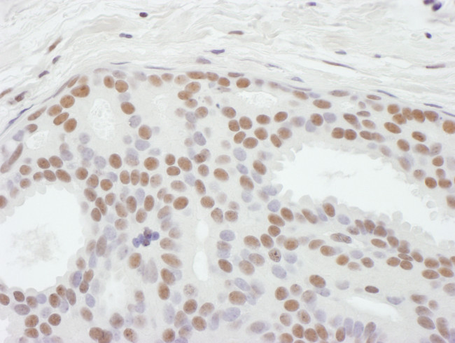 ASH2 Antibody in Immunohistochemistry (Paraffin) (IHC (P))