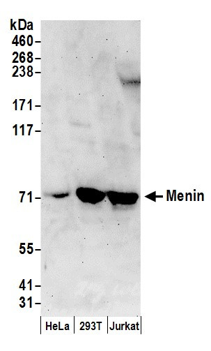 Menin Antibody in Western Blot (WB)