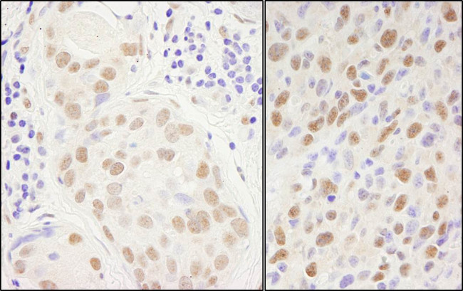 Sp1 Antibody in Immunohistochemistry (Paraffin) (IHC (P))