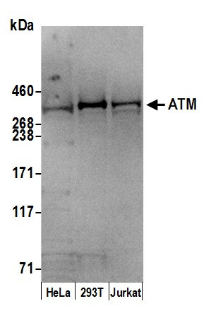 ATM Antibody in Western Blot (WB)