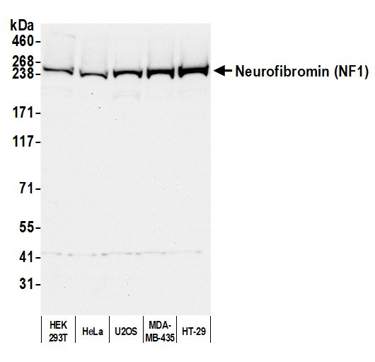 NF1 Antibody in Western Blot (WB)