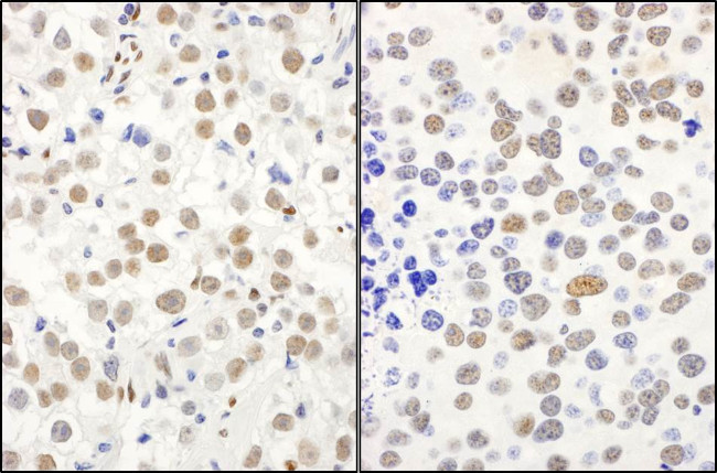 QKI Antibody in Immunohistochemistry (Paraffin) (IHC (P))