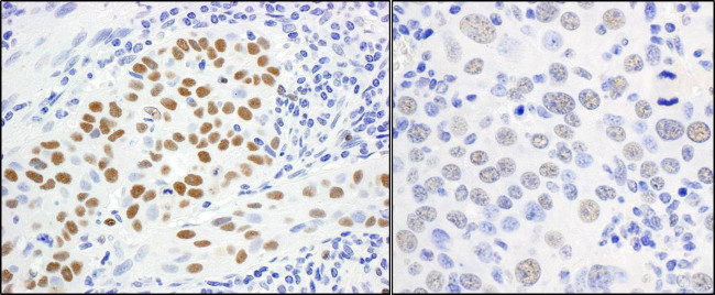 MCM5 Antibody in Immunohistochemistry (Paraffin) (IHC (P))