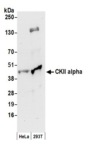 CKII alpha Antibody in Western Blot (WB)