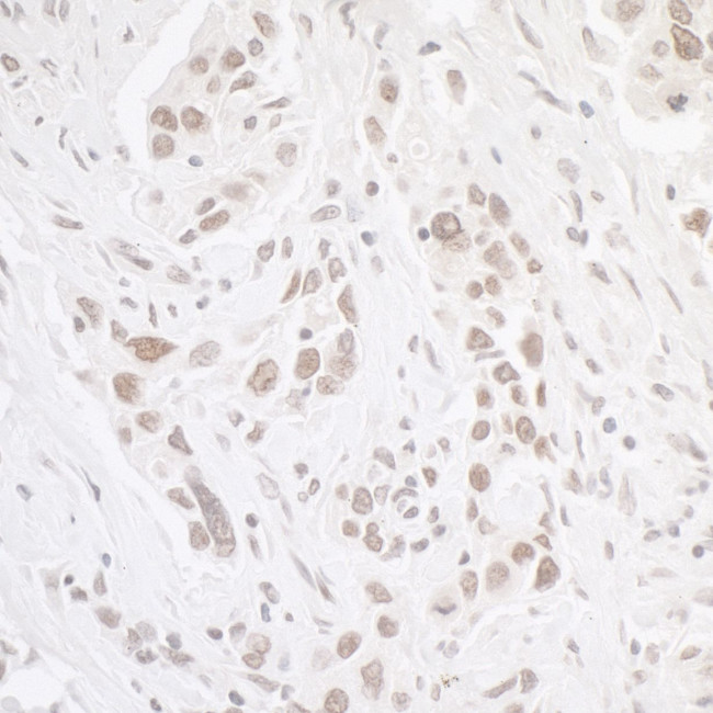 CKII alpha Antibody in Immunohistochemistry (Paraffin) (IHC (P))