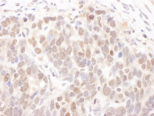 CKII alpha Antibody in Immunohistochemistry (Paraffin) (IHC (P))