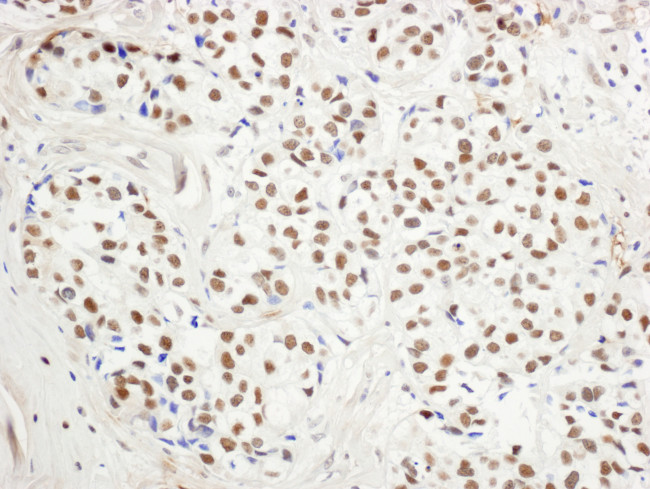 BHC110/LSD1 Antibody in Immunohistochemistry (Paraffin) (IHC (P))