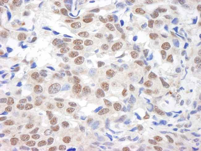 BHC110/LSD1 Antibody in Immunohistochemistry (Paraffin) (IHC (P))