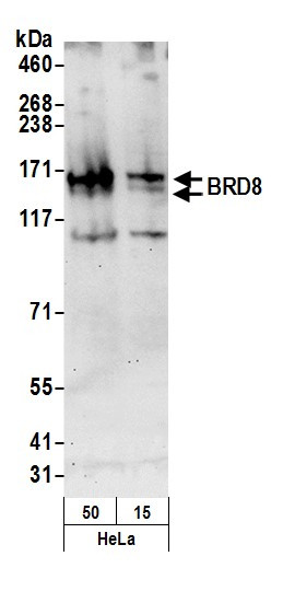 BRD8 Antibody in Western Blot (WB)