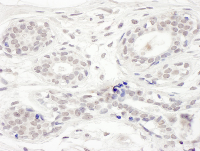 BRD8 Antibody in Immunohistochemistry (Paraffin) (IHC (P))