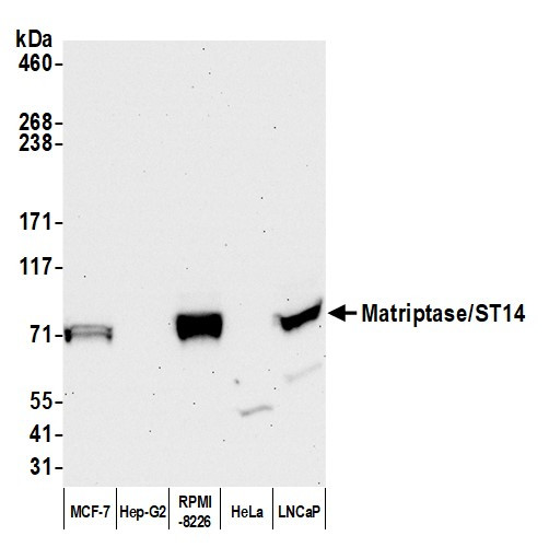 Matriptase/ST14 Antibody in Western Blot (WB)