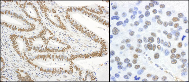 Phospho-XRCC1 (Ser485, Thr488) Antibody in Immunohistochemistry (Paraffin) (IHC (P))