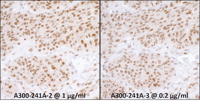 RPA70 Antibody in Immunohistochemistry (Paraffin) (IHC (P))