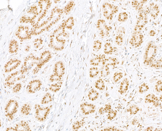 RPA32 Antibody in Immunohistochemistry (Paraffin) (IHC (P))