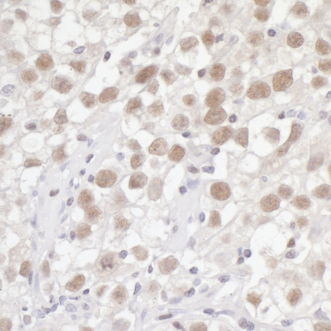 Fen1 Antibody in Immunohistochemistry (Paraffin) (IHC (P))