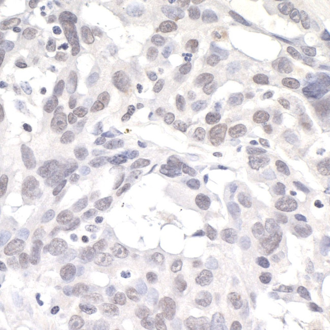 PNK1 Antibody in Immunohistochemistry (Paraffin) (IHC (P))